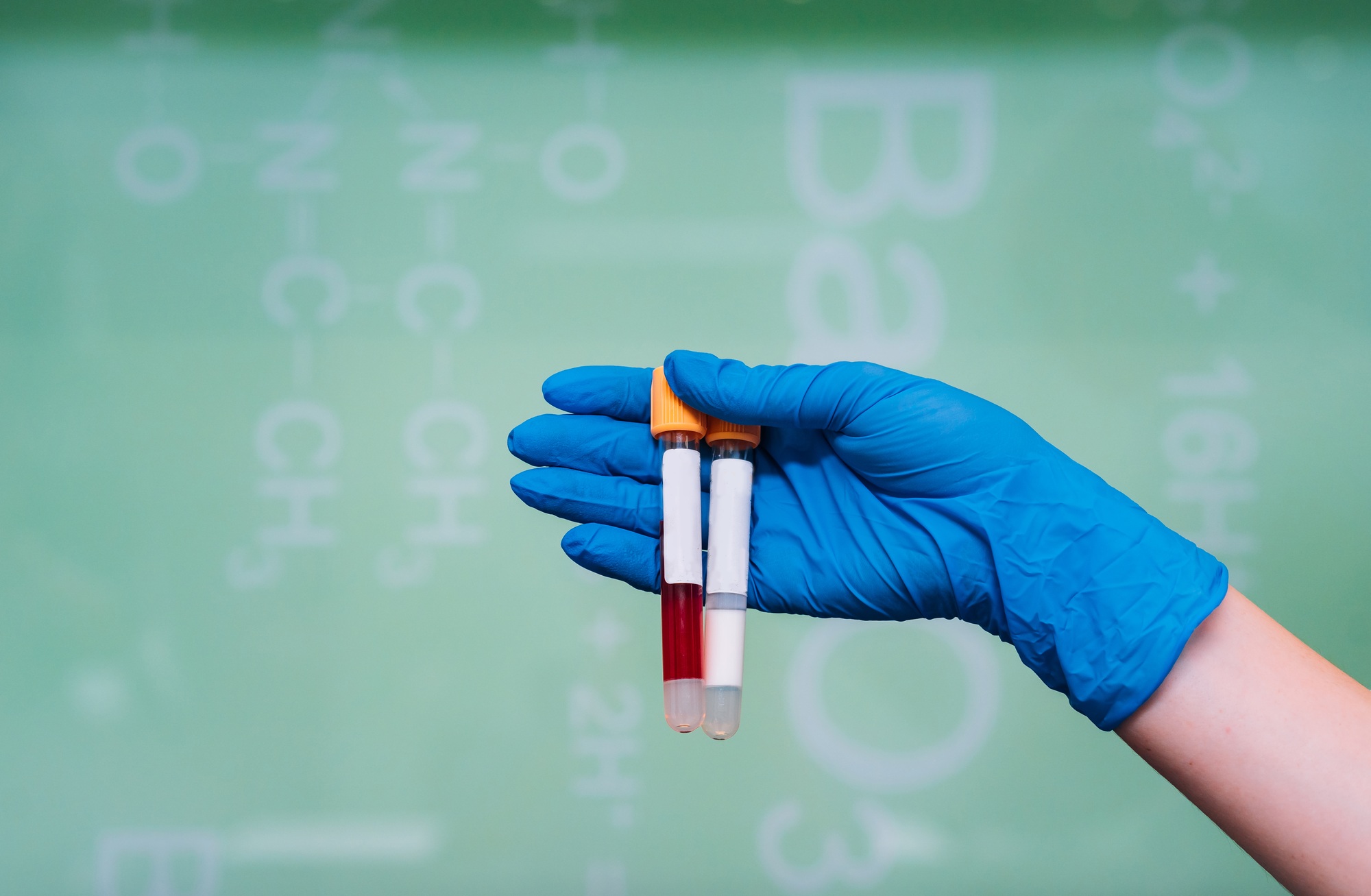 A rubber-gloved hand holds two test tube with the drug