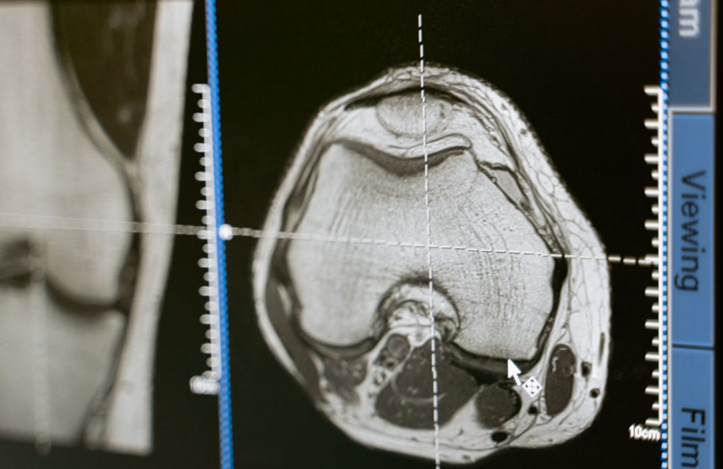 Quantum MRI